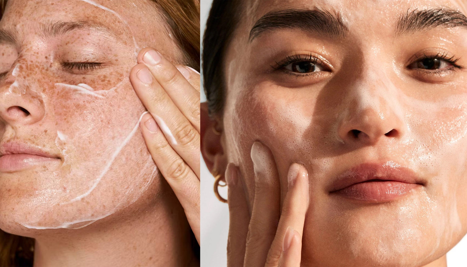 Best face wash for acne