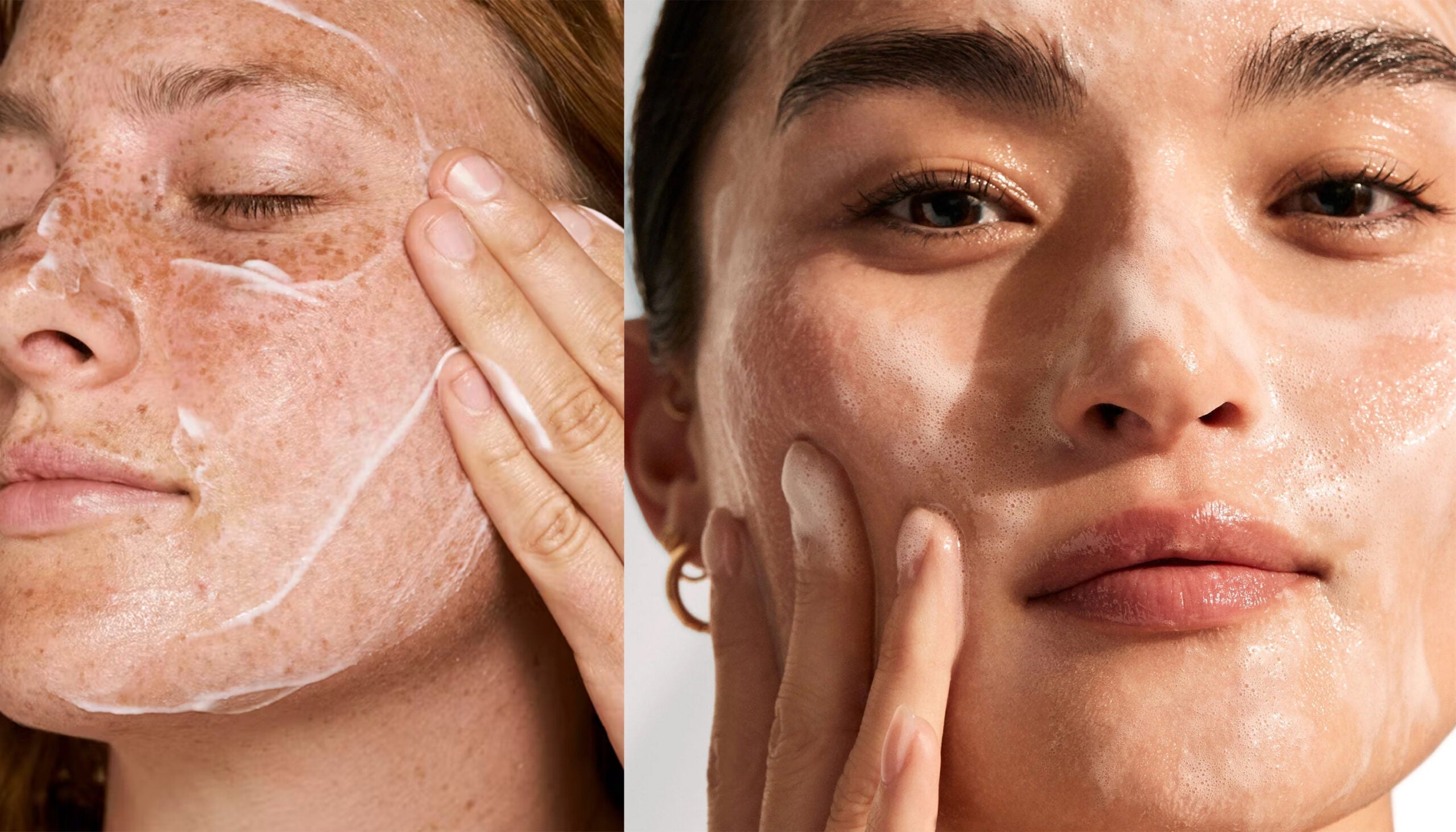 Best face wash for acne
